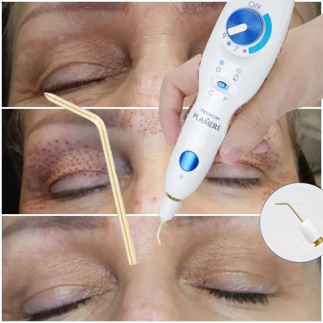 

Plamere Pen – Plamere Premium Device With Battery Fibroblasts Cells Growth