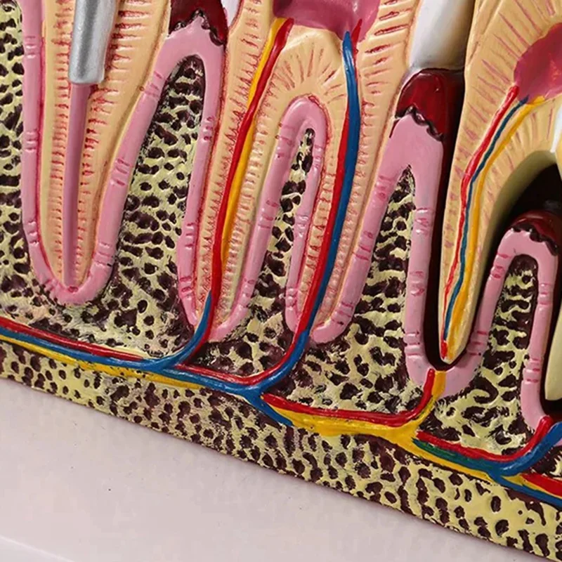 ABNO-Standard  Oral Teeth Anatomical Teaching Model Comprehensive Tooth Structure Model Dentist  Demonstration