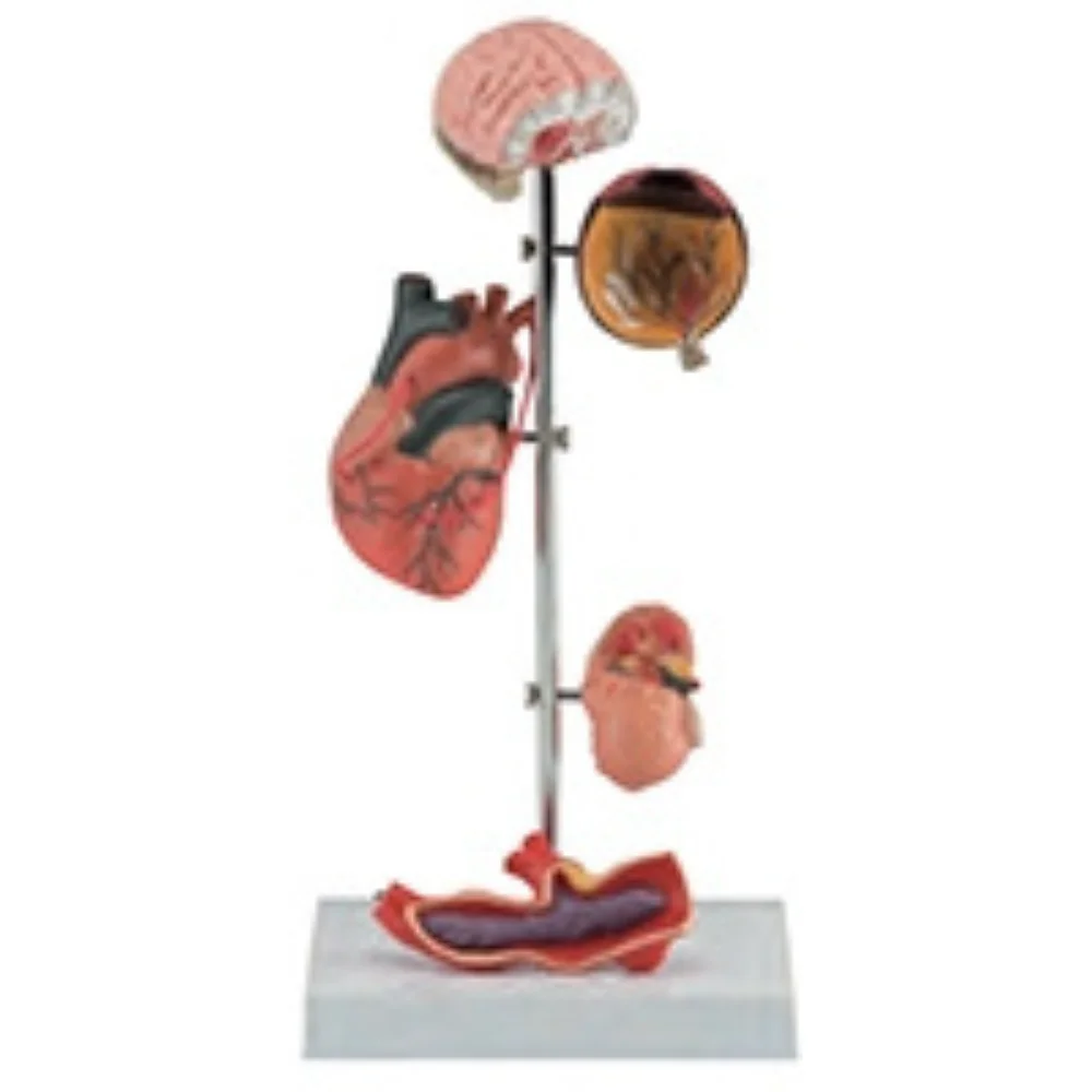 Hypertension Model Human Anatomy Medical Skills Training Simulator Educational Assistance Equipment