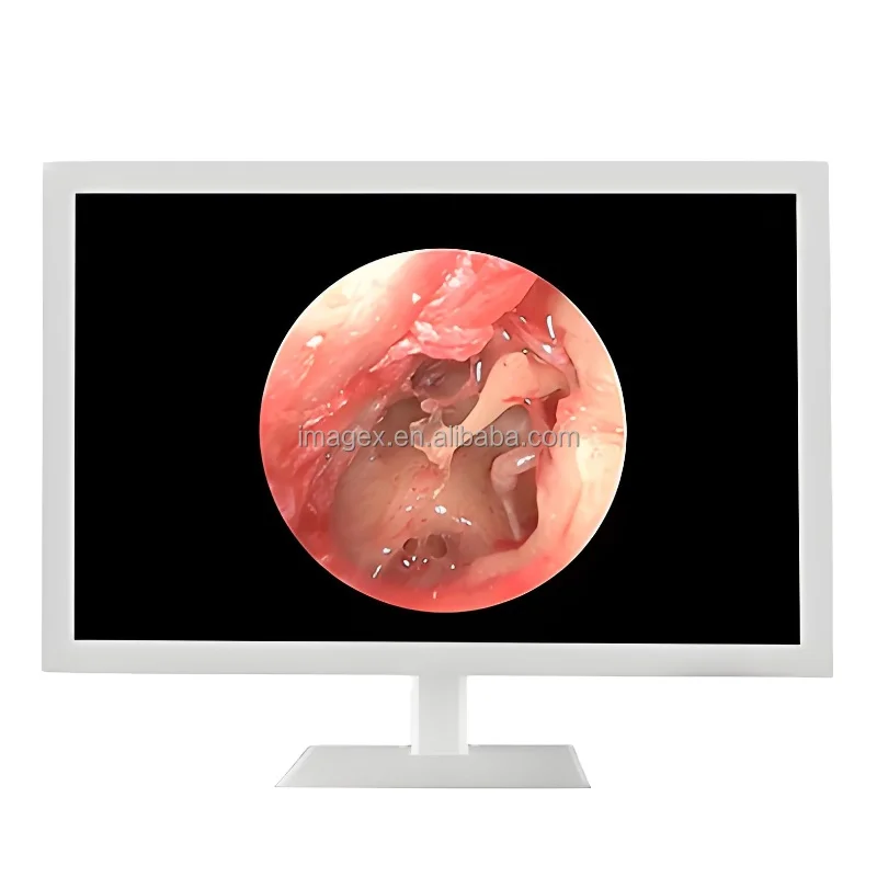 24inch 27inch 32inch High-Resolution Endoscopic with HDMI