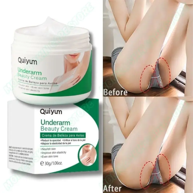 

Body Beautifying Cream Private Parts Underarm Bleaching Serum Butt Knee Lightens Intimate Parts Dark Remove Melanin Moisturizes