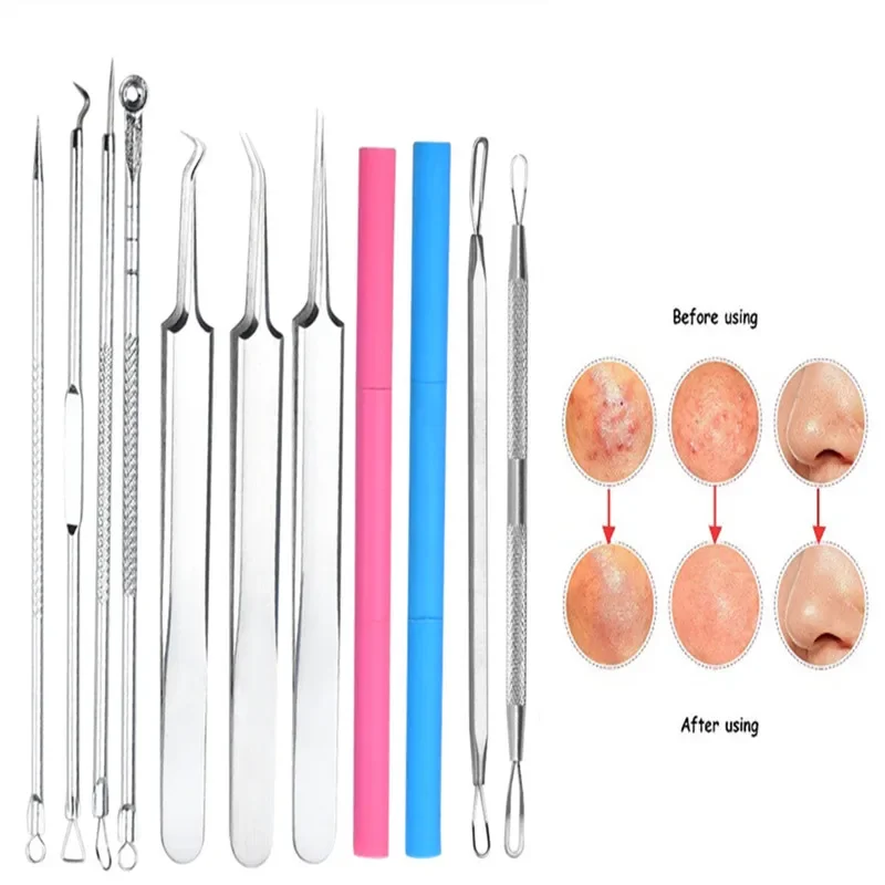 

11Pcs Face Skin Care Pore Cleaner Needles Removal Tool Stainless Steel Blackhead Comedone Acne Needle Remover Clip Pimple Needle