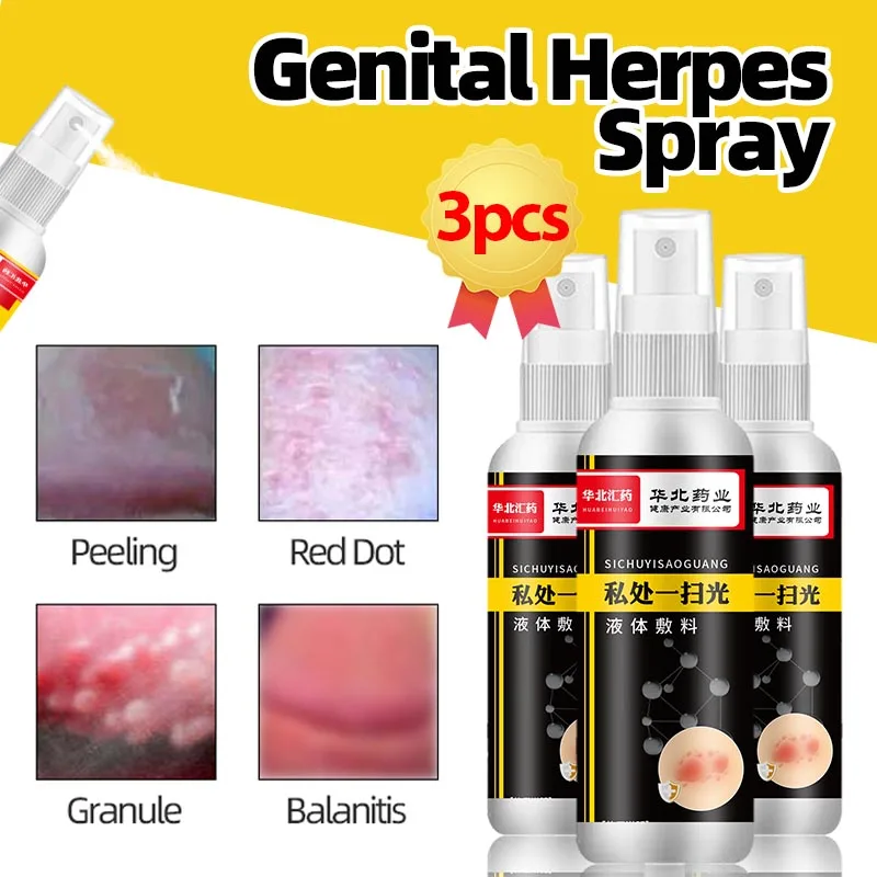 3Bottles Genital Herpes Removal Balanitis Candida Treatment Spray for Men Ointment Medicine Cure Pearly Papules Remover 50ml