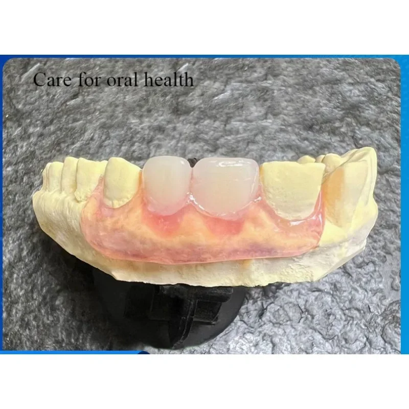 Dental Dentures Custom Incisor Missing Teeth Filling Teeth Invisible Transparent Activity Shading Resin Plastic Steel Dentures