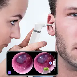 Wifi Ear Otoscope 3.9mm Smart Wireless Portable Visual Earwax Cleaning Endoscope Camera for iPhone Android Phone iPad