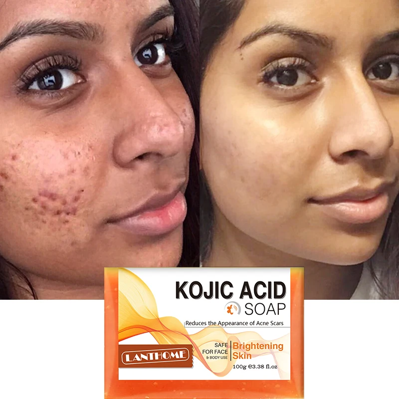 Kojic Acid Soap Whitening Soap Facial Deep Cleaning Even Skin Tone Lightening Soaps Oil Control Moisturizing Skin Care Product