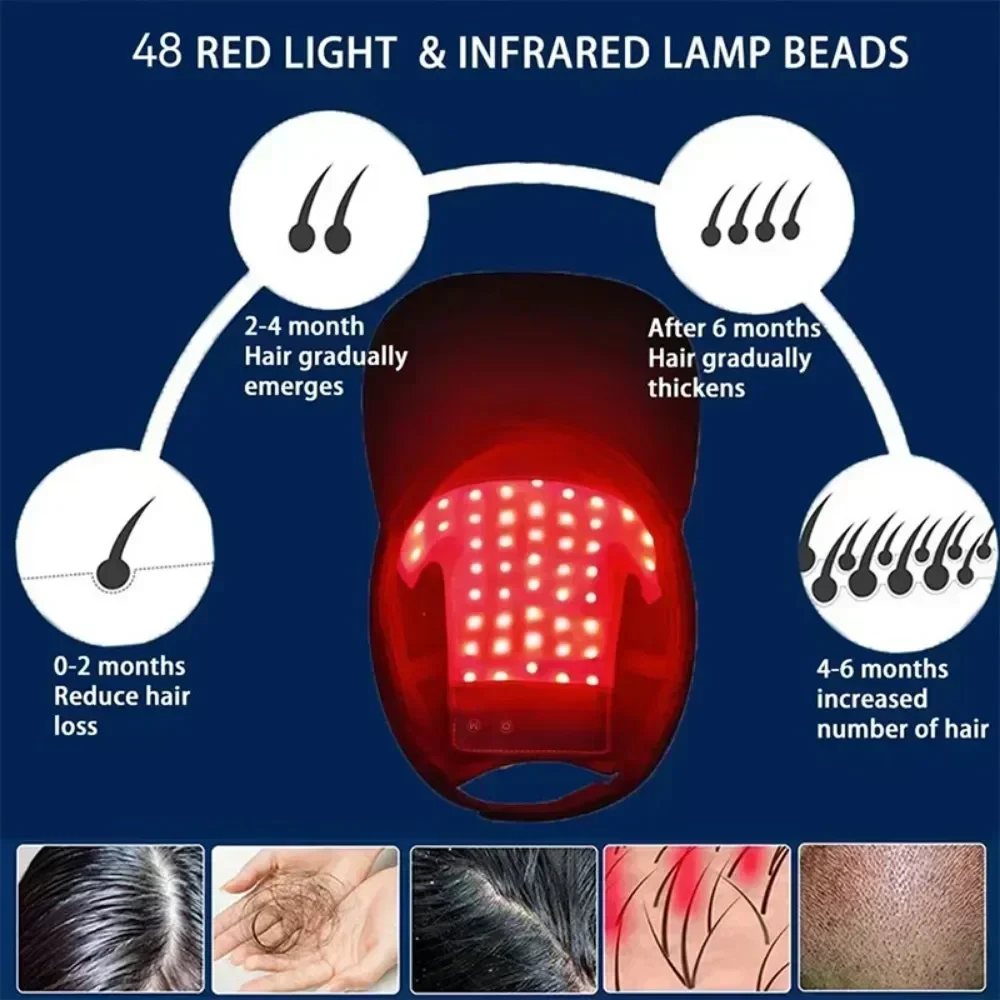 ZONGKUNG Red Light Therapy for Hair Growth Cap Red & Infrared Light Therapy Device for Hair Loss Treatment with USB Charging