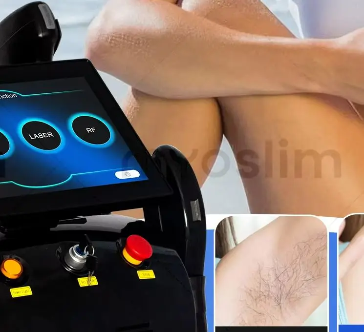

4 IN 1 Soprano Titanium Ice Platinum RF Diode 755 808 940 1064nm 4 Wave PICO Laser ND:YAG Painless Hair Removal Machine