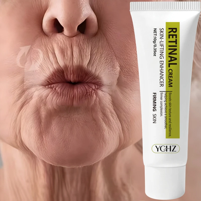 Retinol Firming Eye Cream, Gently Moisturizes the Eye Area, Deeply Hydrates and Nourishes, Has a Gentle Texture, Suitable for Both Men and Women, Adapts to Various Skin Types, and Is Ideal for Daily Eye Care