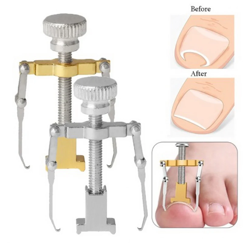 Straightening Clip Ingrown Toenail Corrector Pedicure Foot Nail Care Tools Stainless Steel Pedicure Treatment Onyxis Correction