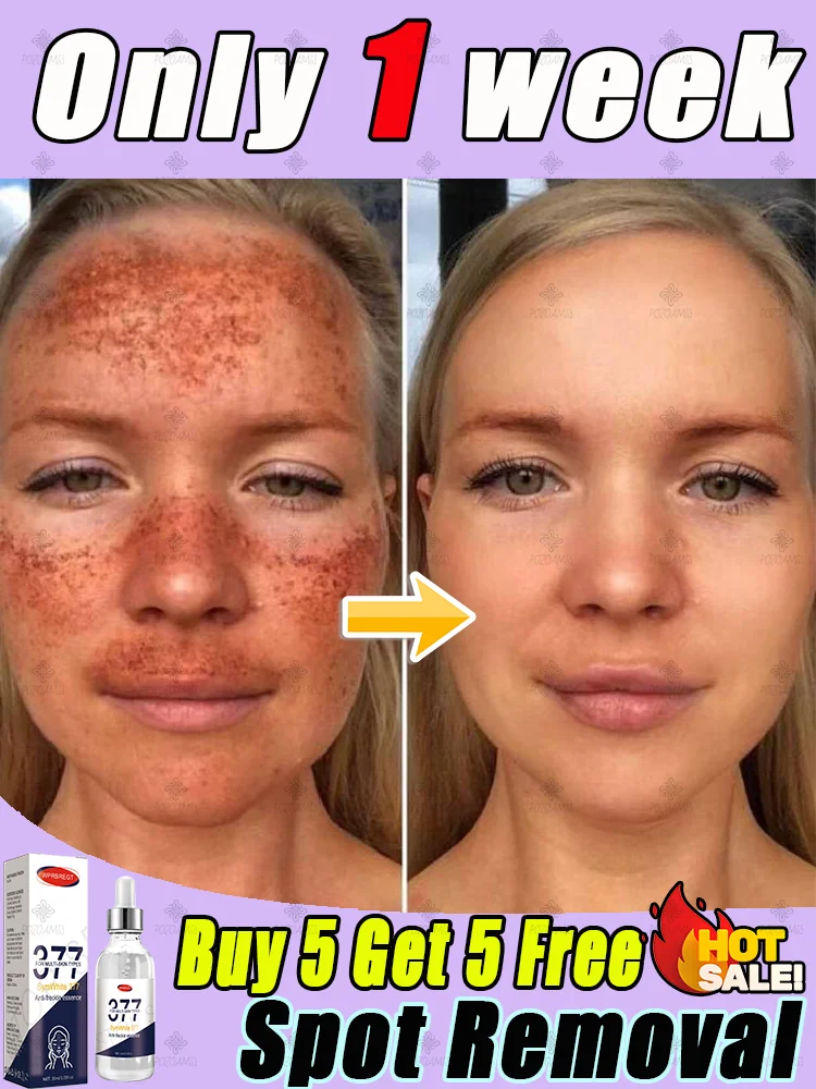 肌の色ムラを効果的に除去し、完璧な肌を取り戻します