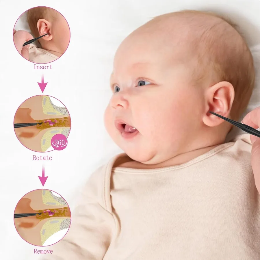 QGrips Ear Wax RemovalSpiral Ear Wax Removal Tool 6PCS Reusable Earwax Removal Kit Safe Ear Cleaner Soft Silicone Double Sided