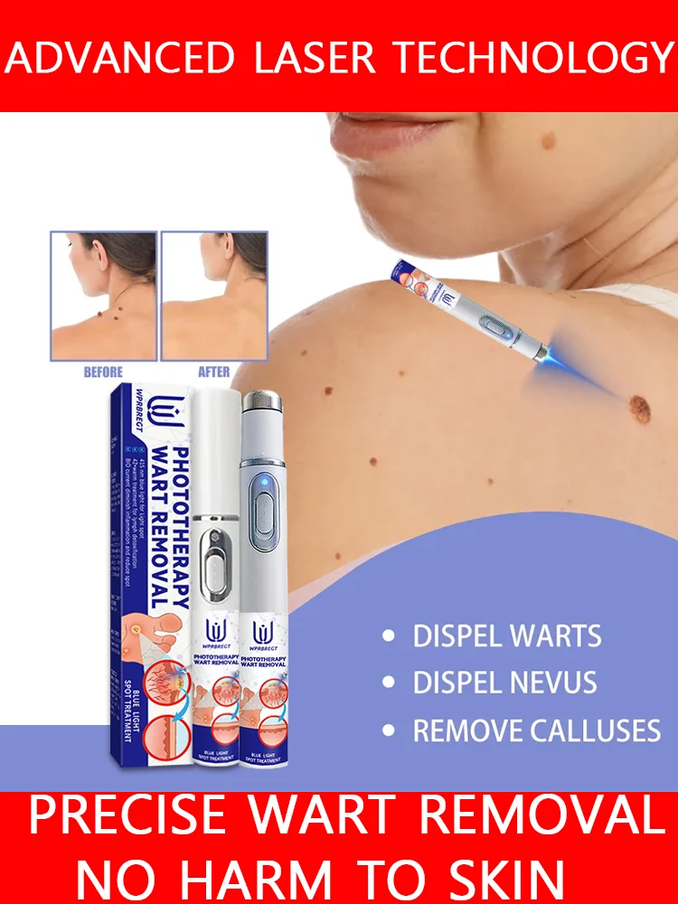 

Safe & Portable Wart Removal Laser Pen - Precise & Easy to Use, CE Certified, Home Use Friendly, No Scarring Risk