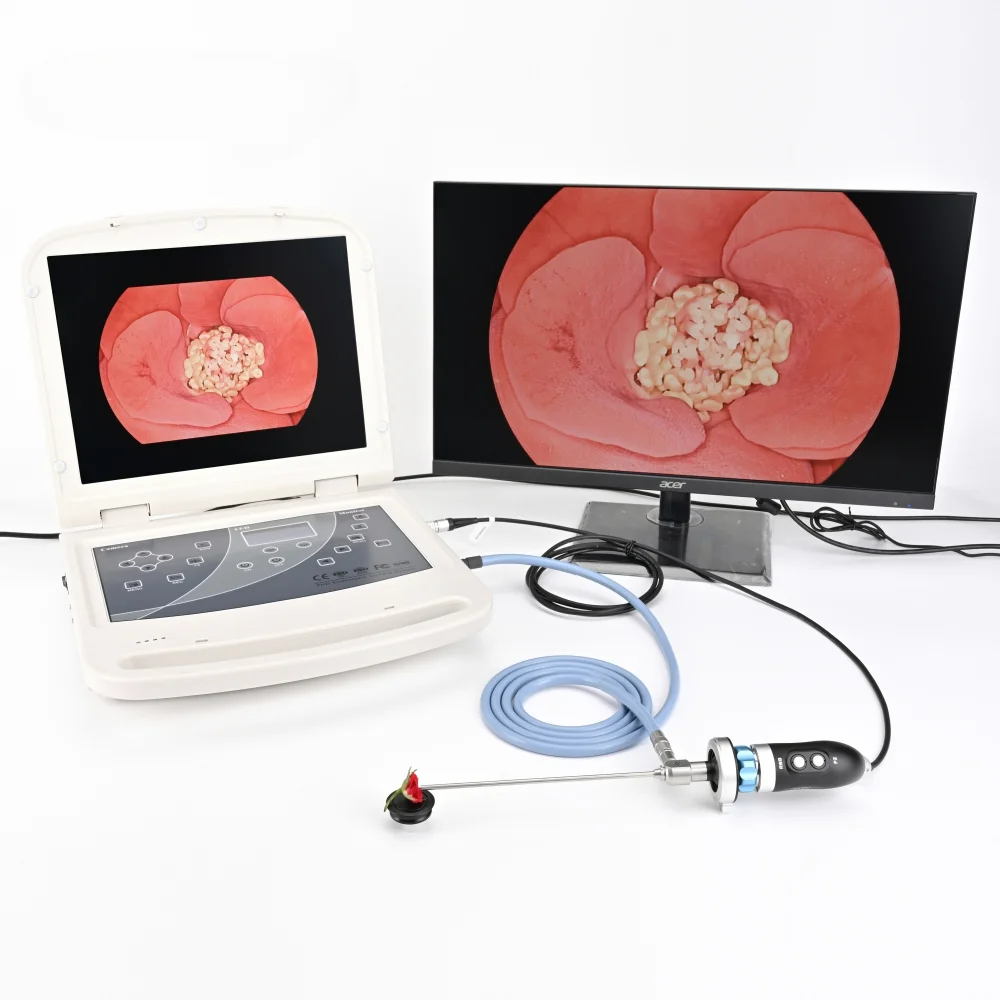 Medical Portable 3 in 1 Endoscopic Camera System with 15.6 Inch Monitor, 60W Led Light Source and USB Record