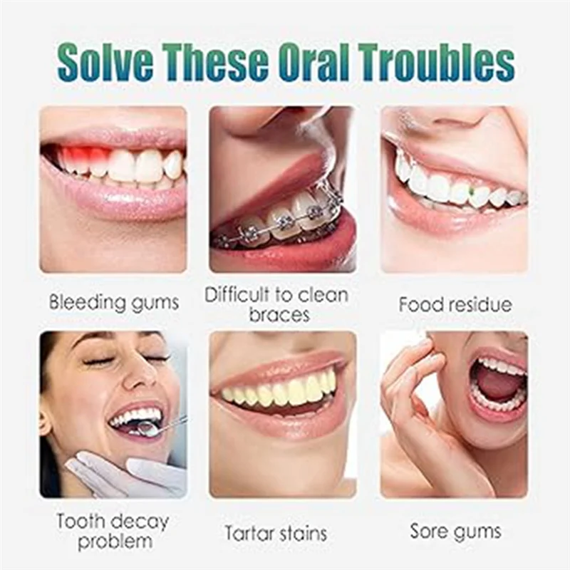BBNV-Электрическое полоскание зубов, очиститель для ухода за полостью рта, электрическое устройство для чистки и удаления зубов, портативное бытовое устройство CY9