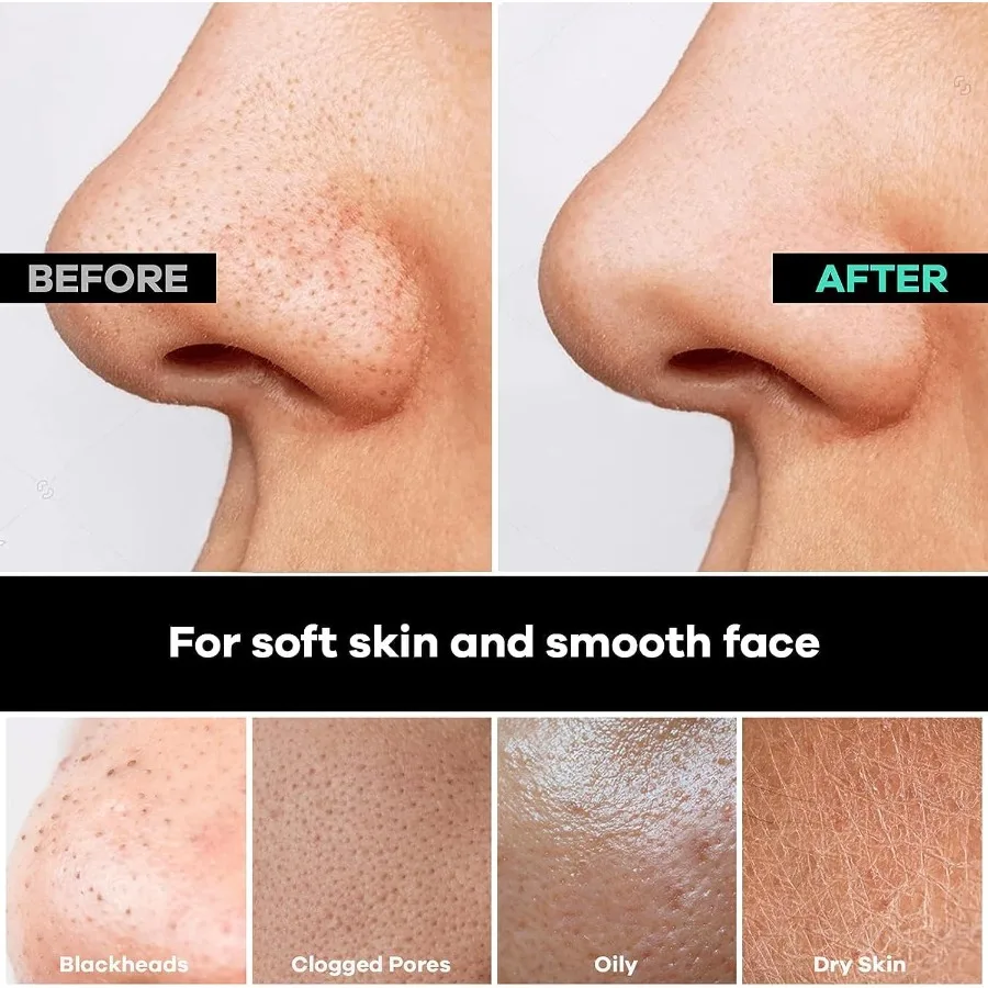 Luva esfoliante profunda para rosto, removedor de pele morta e seca para homens e mulheres, luvas esfoliantes para banho e uso seco, 1 pacote