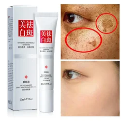 Freckle Whitening Creme para Rosto Escuro, Remover Mancha, Melasma, Clareamento Profissional, Anti-pigmentação, Melhorar o embotamento, Cuidados com a pele