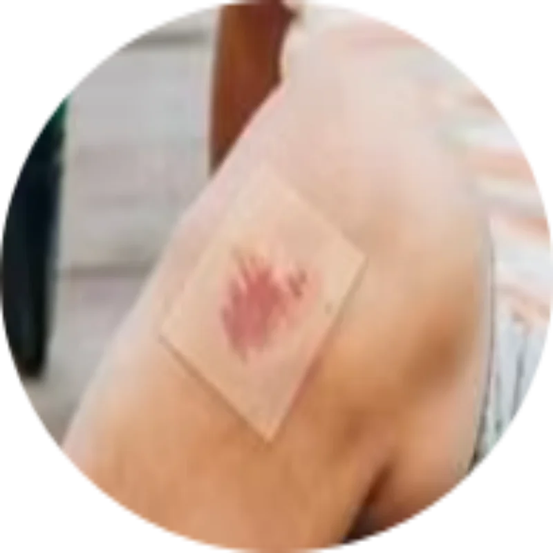 rolo-hidrocoloide-altamente-absorvente-1-peca-para-cuidados-com-feridas-ataduras-autoadesivas-curativos-doloridos-de-cama-para-queimaduras-e-alivio-de-feridas