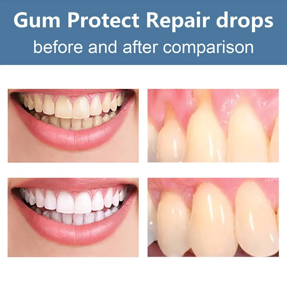 30ML Quickly Gum Repair Serum Drops Relief Periodontal Toothache Gum Protect Repair Drops Teeth Whitening Toothpaste Oral Care