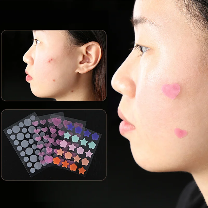 Mini Ster Vlinder Onzichtbare Acne Verwijdering Puistje Patch Puistje Acne Concealer Gezicht Gezicht Gezicht Huidverzorging Stickers Schoonheid Acne Tool