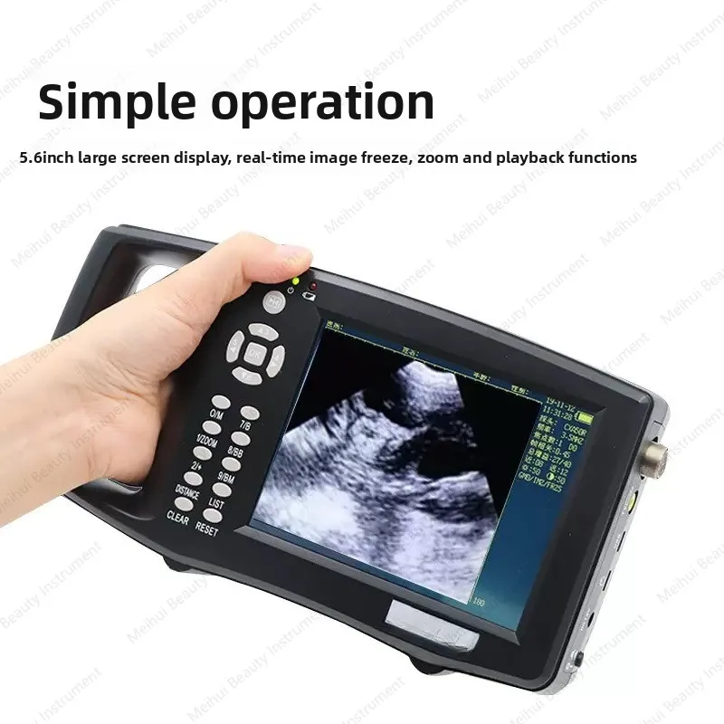 Animal High-definition Large Screen for Sheep, B-ultrasound for Wagyu Cattle, Sheep and Cows