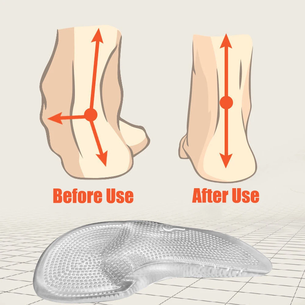 Orthopädische Silikongel-Einlegesohlen für Damenschuhe, Plattfuß-Unterstützung, Fußpolster für Plantarfasziitis-Schmerzlinderung – Detail 5