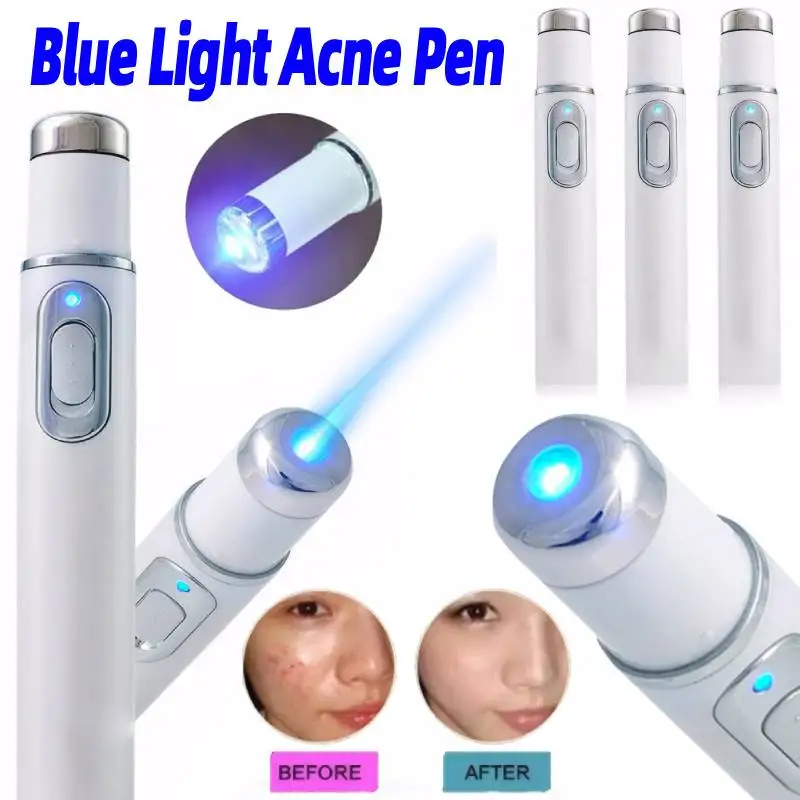 Terapia della luce blu Penna per l'acne Dispositivo per la bellezza degli occhi Strumento per il massaggio degli occhi Strumento per la cura delle occhiaie Borse per gli occhi Gonfiore sotto gli occhi