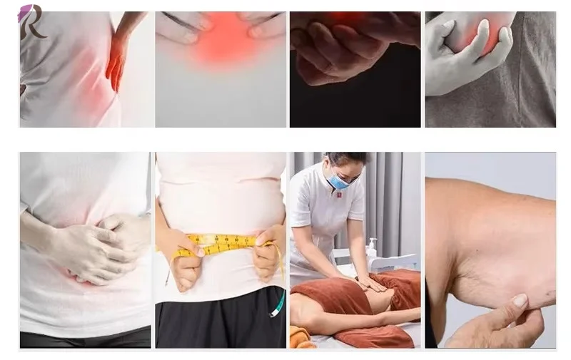 Professional Original ManufacturerHome Diathermy Physiotherapy Smart Tecar Therapy Body Sport Injury Pain Relief Tecar Device