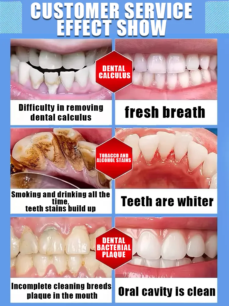 2025 waterproof intraoral repair patch, tooth correction patch, damaged and discolored intraoral care tool