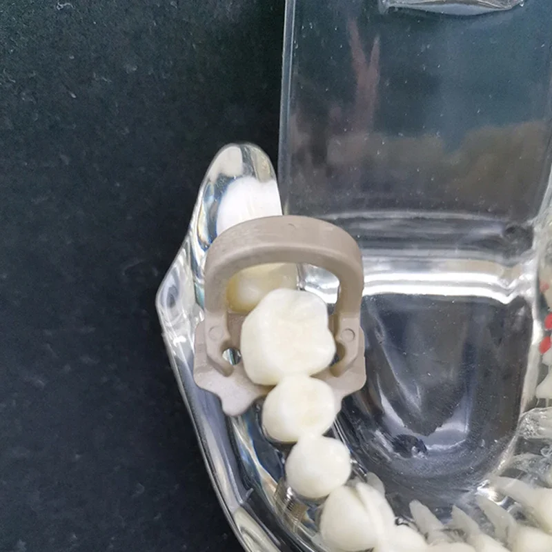 مشابك سد مطاطية للأسنان، مشابك حاجز من مادة الراتنج لعزل الأسنان والإجراءات الترميمية وأدوات المختبر