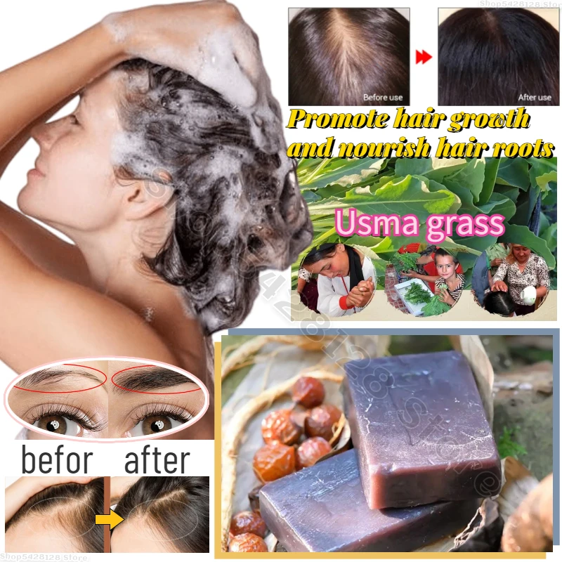 

Xinjiang Usman Grass Shampoo Soap Gentle Cleansing Promotes Hair Growth Repairs Damaged Hair Follicles Handmade Soap 100g