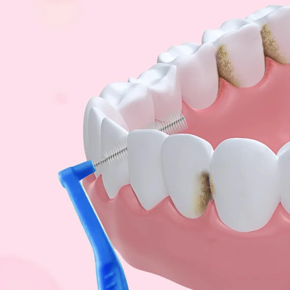 Sikat Interdental untuk ortodontik gigi bersih antara gigi alat pembersih sikat Mini lembut dengan penutup debu cepillo interdental