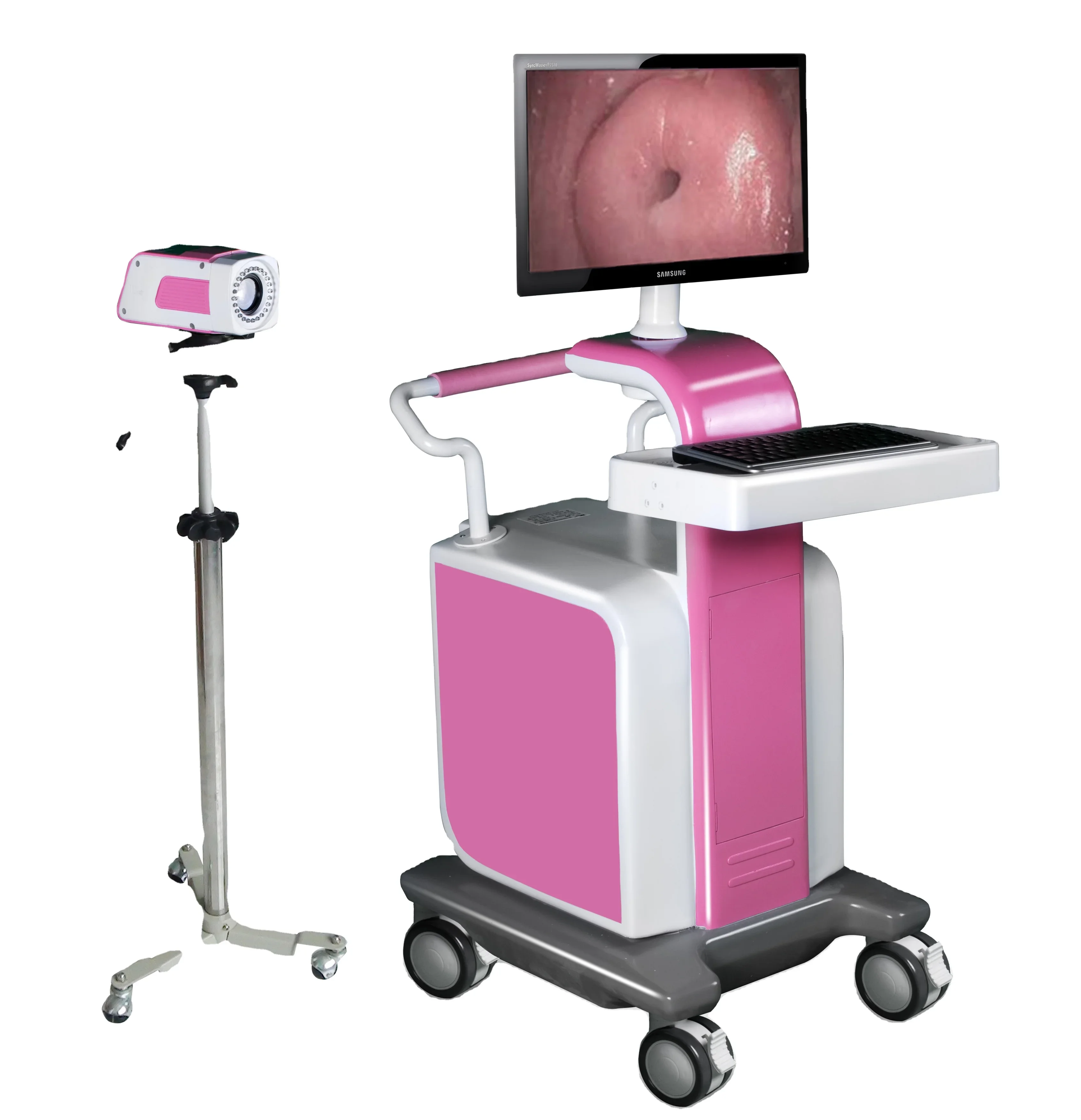 

Hospital Gynecology Video vagi nal Endoscope Portable Trolley HD Digital Electronic colpos cope