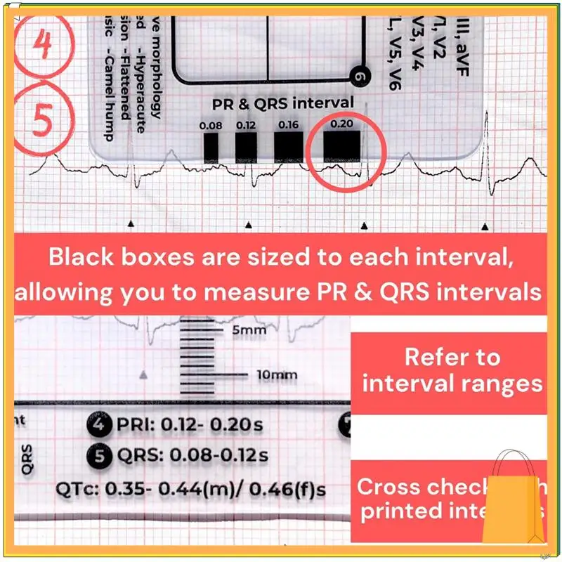 L52A-ECG 7-шаговая линейка, шаговая линейка ЭКГ 7-шаговая линейка для тердавления ЭКГ/ЭКГ, инструмент для быстрого и быстрого анализа кардиологии и измерения