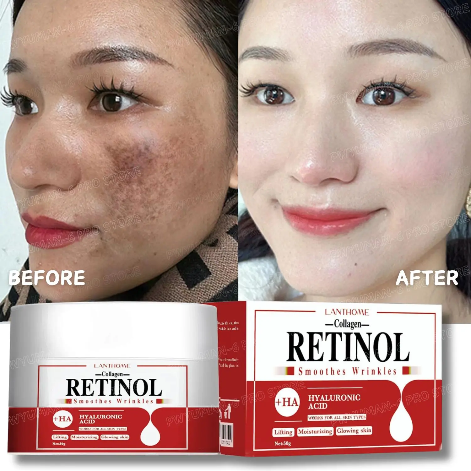 Face Body Whitening Cream Retinol Collagen Hyaluronic Acid 3in1 Remove Dark Spots Eliminate Melanin Dispel Acne Lighten The Skin