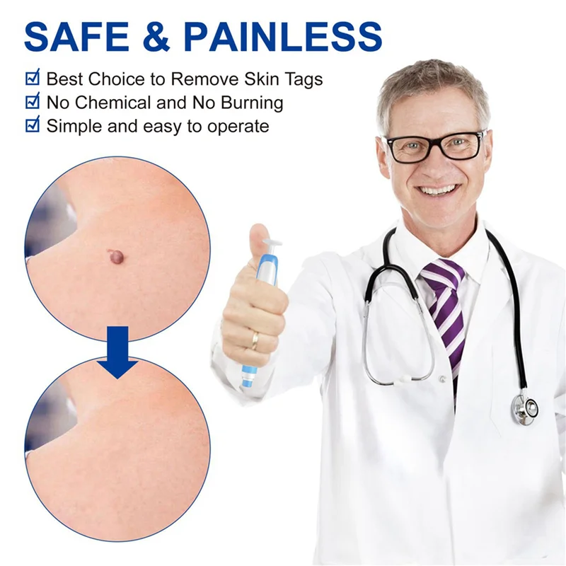 【¡Venta flash!】2X Kit de eliminación de etiquetas de piel pluma de eliminación de etiquetas de piel indolora dispositivo de eliminación de etiquetas de piel fácil elimina las etiquetas de la piel de 4Mm-9Mm