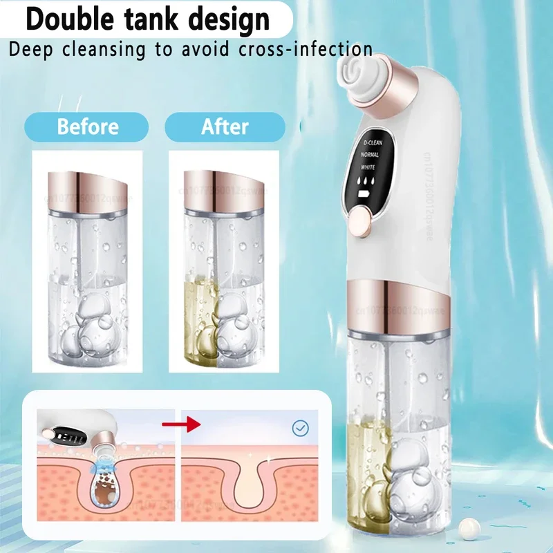 Blackhead Remover Pore Vacuum Face Cleaner Electric Pimple Acne Black Head Removal USB Rechargeable Water Cycle Black Dot Remove image 4
