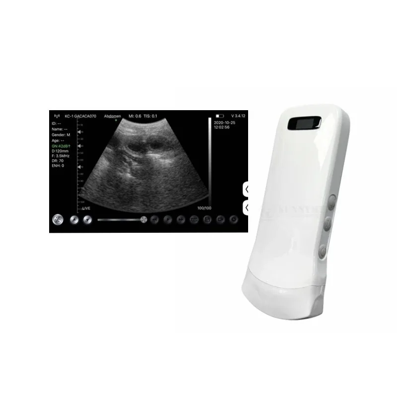 Wireless Black White Ultrasonic Detection Probe Convex Detection Transducer Student Training Testing Equipment