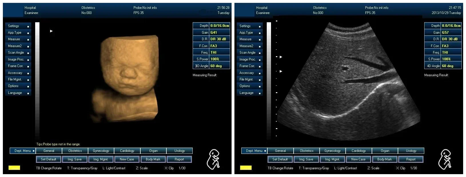 3D 4D Full Digital Medical Doppler Ultrasound cheap medical ultrasound instruments Sunbright