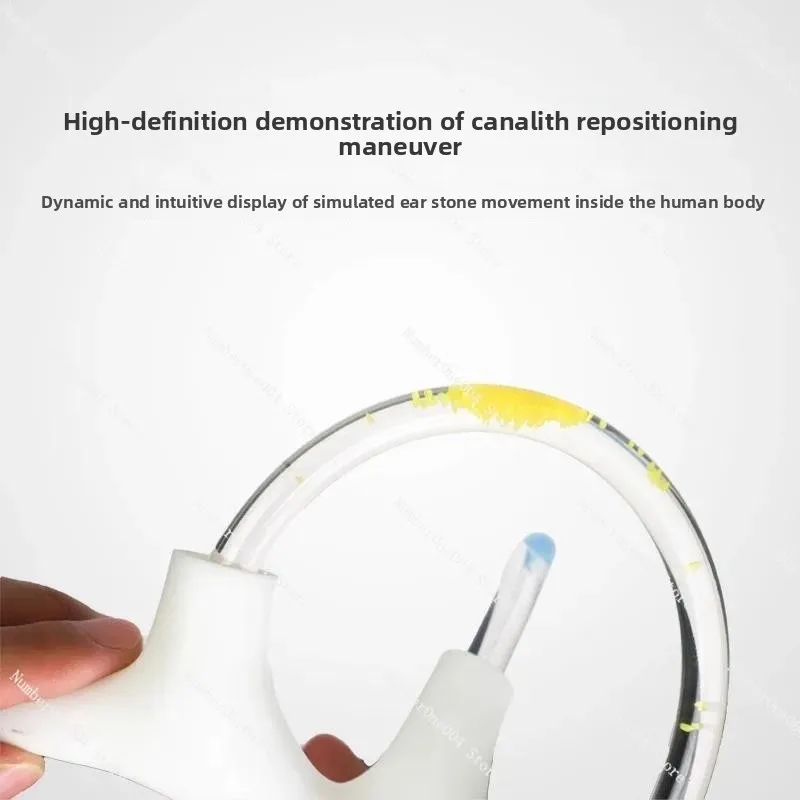 Semicircular Canal Model with Otoconia Inner Ear Anatomy Vestibular Rehab Teaching Aid