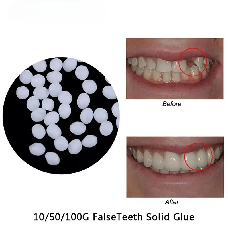 10 جرام/الحقيبة طقم تصليح الأسنان-خرز حراري لملء إصلاح الأسنان المفقودة والمكسورة أو لاصق طقم الأسنان وهمية جوتا لكل #1