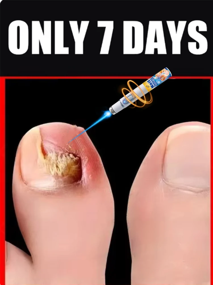 

Высококачественный рекламный инструмент для массажа ногтей с синим светом