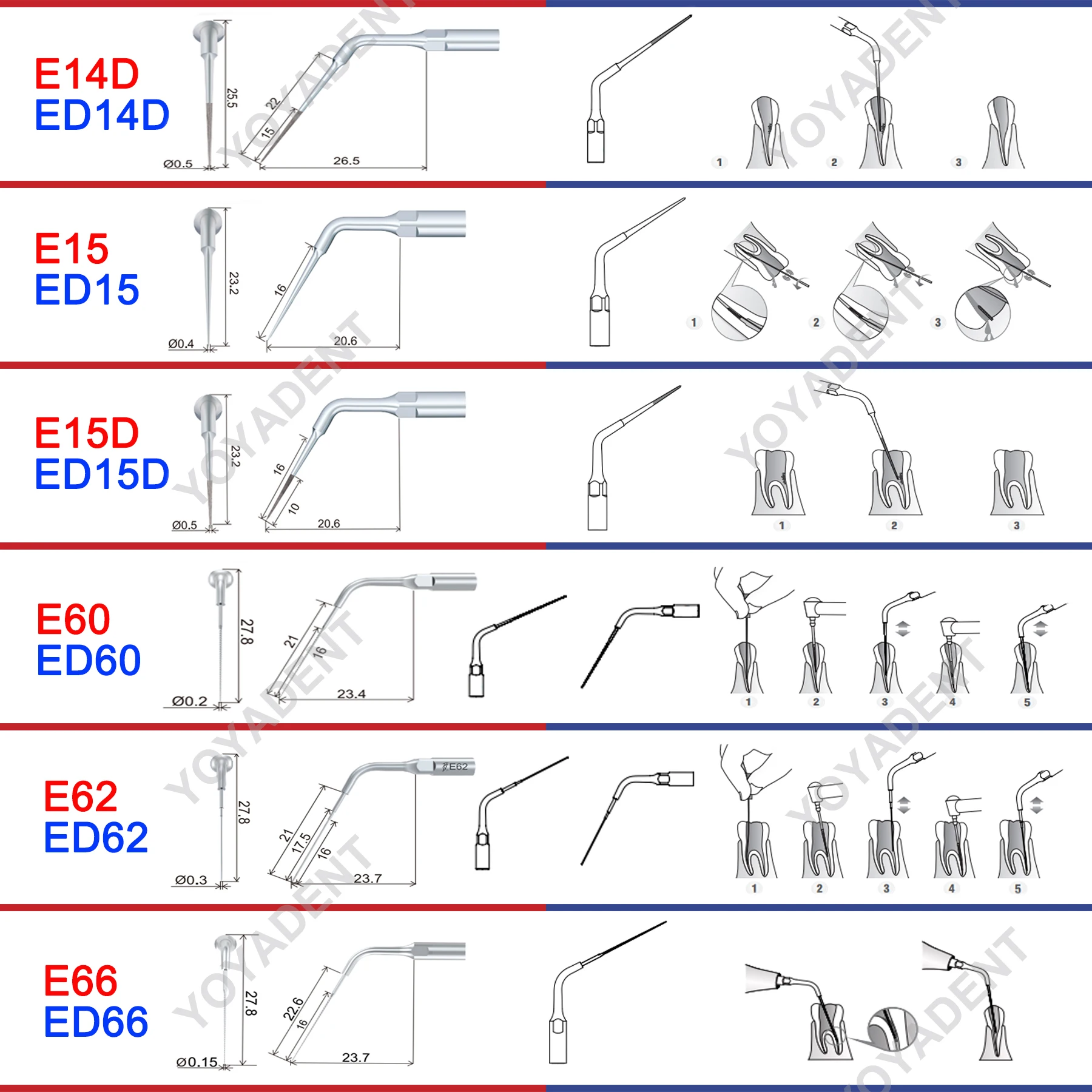 Woodpecker DTE Dental Endo Tips Ultrasonic Scaler Tips Scaling Tips ED-Series Fit NSK SATELEC Scaler Handpiece Dentistry Product