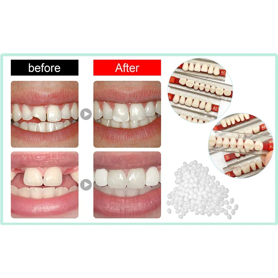 Dental Oral Materials Teaching Model A2 of Maximum Standard Size Teeth Upper and Lower Model for Replacement Orthodontic