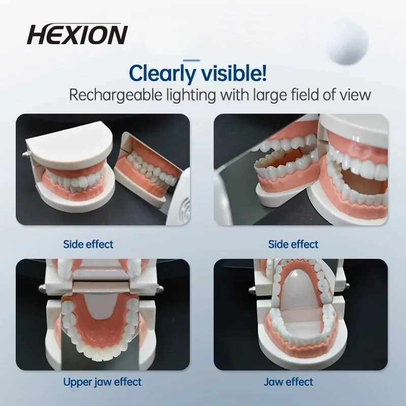 HEXION 3-20 Pcs Automatic Anti-Fog Dental Mirror Oral Photography Reflector Orthodontic Buccal Occlusal Lingual Defog Mirror
