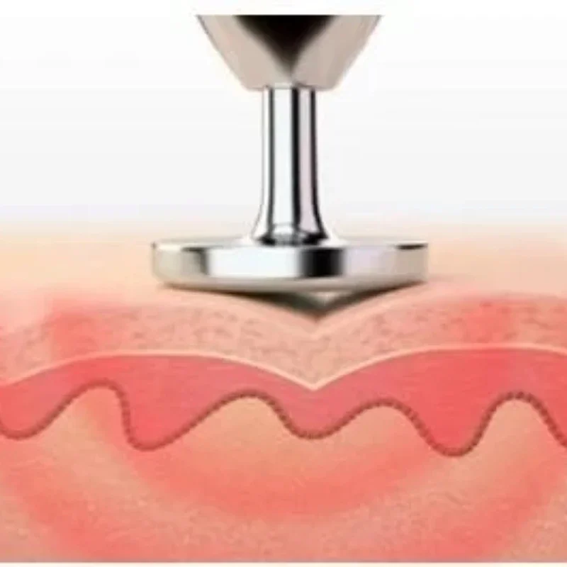 Plasma, Huidverstrakking En Ooglid Lifting, Sproet Verwijdering, Litteken, Pigmentatie, Nevus, anti-Aging Verminderen Litteken Warmte Effect Usb