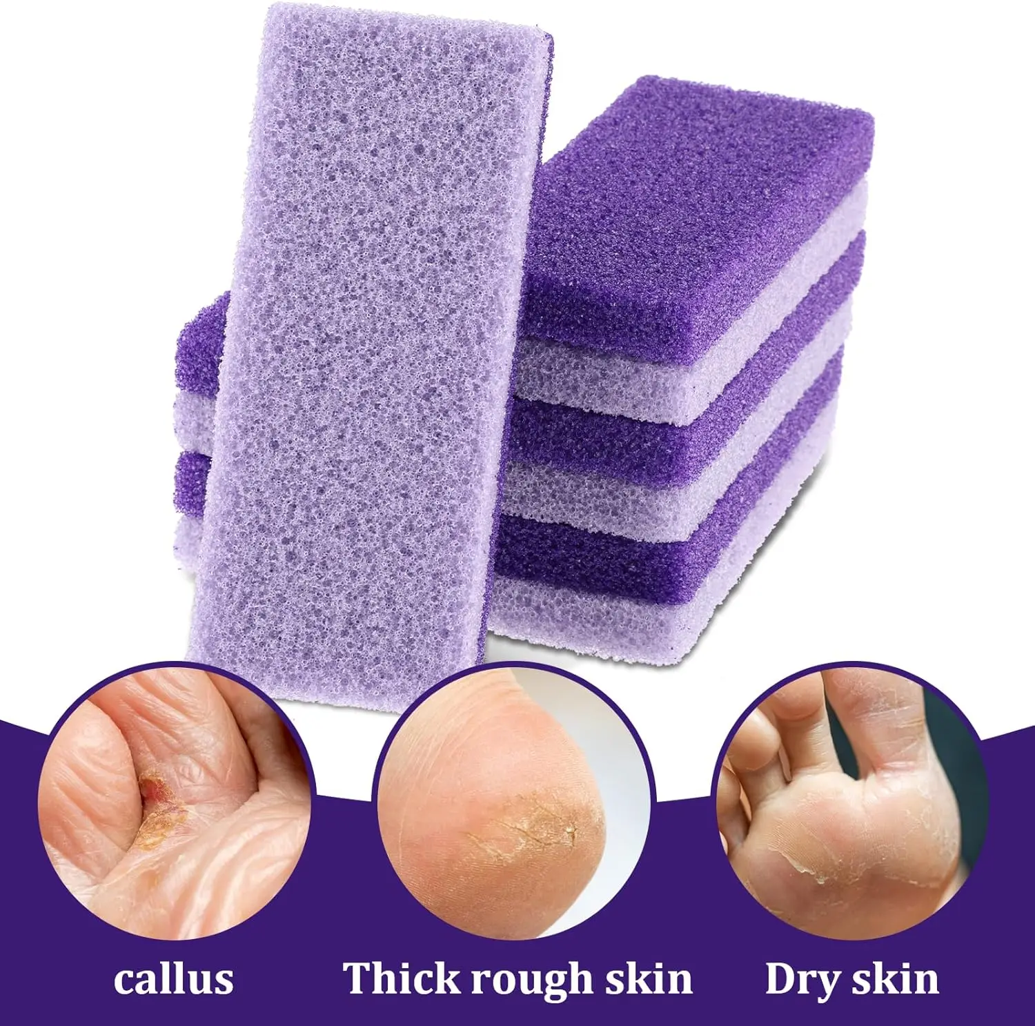 2/4/8 PCS Voetverzorging Exfoliërende Gereedschap Set Voet Puimsteen Bestand Eelt Remover Hak Scrubber Voetverzorging exfoliërende Gereedschappen