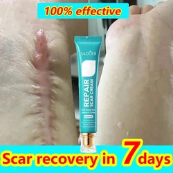 Fast Scar Removal Cream Effective Treatment Stretch Marks Burn Surgical Scars Acne Spot Repair Whiten Moisturizing Skin Care