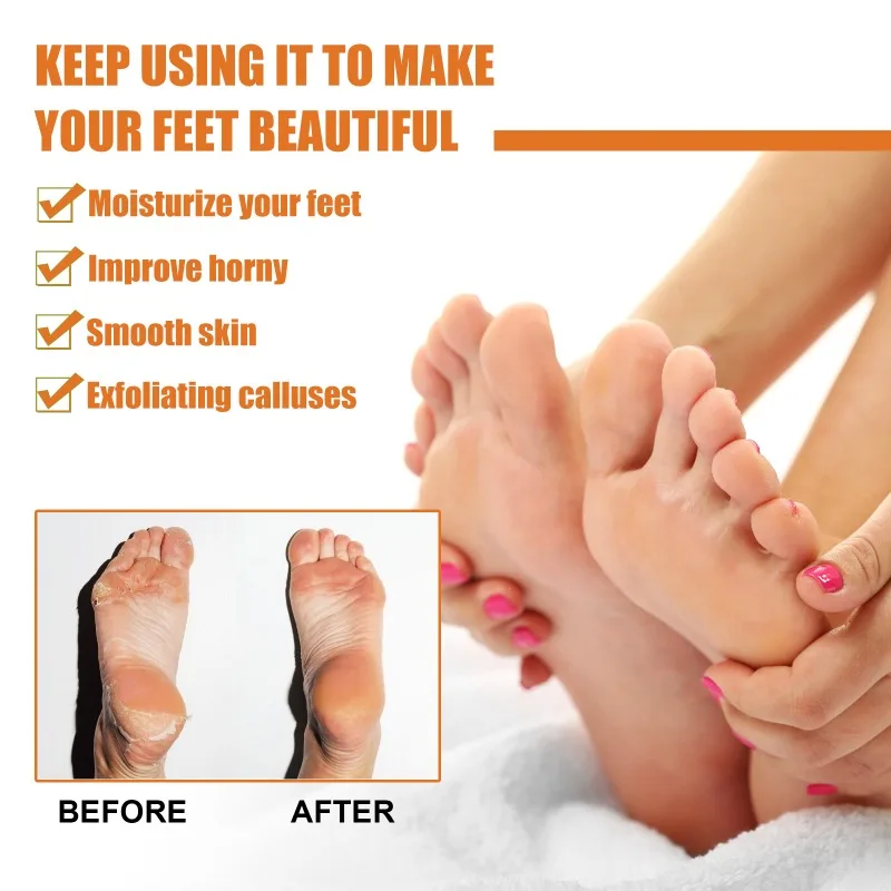 Foot Callus Removal Spray Orange Essential Oil Exfoliating Nourish Peel Feet Calluses Dead Skin Remover Pedicure Foot Care Tool