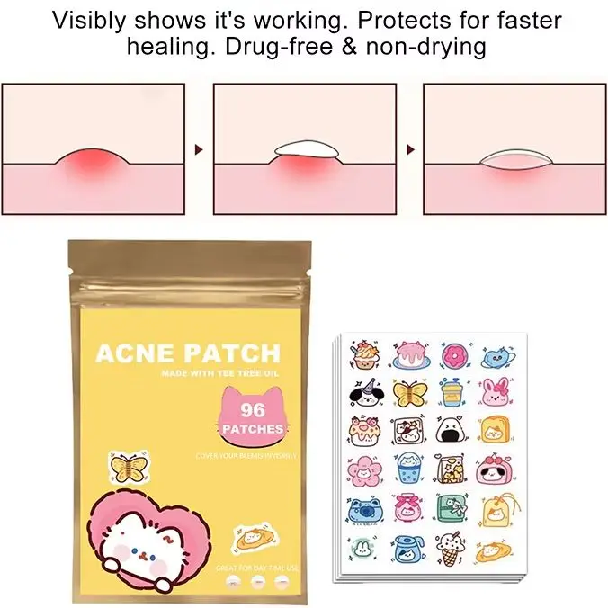 

96pcs Acne Patches Cartoon Cat Shaped Acne Treatment Sticker Invisible Acne Cover Removal Pimple Patch Skin Care